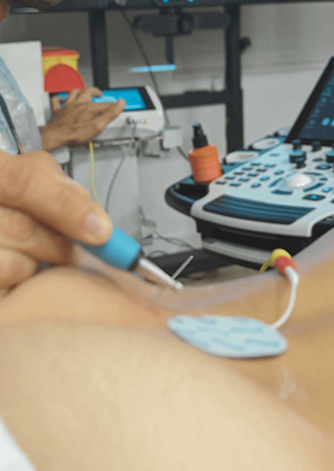 x-neuroeje-ecografia-y-neuromodulacion